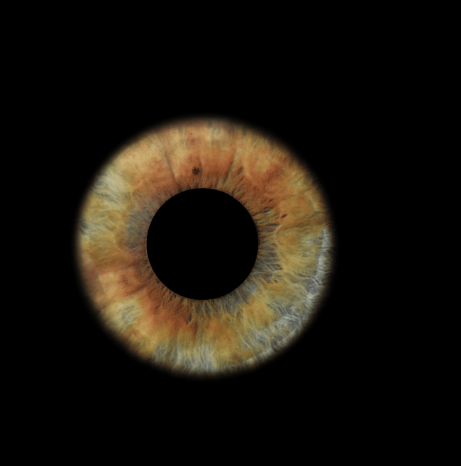 Eye1